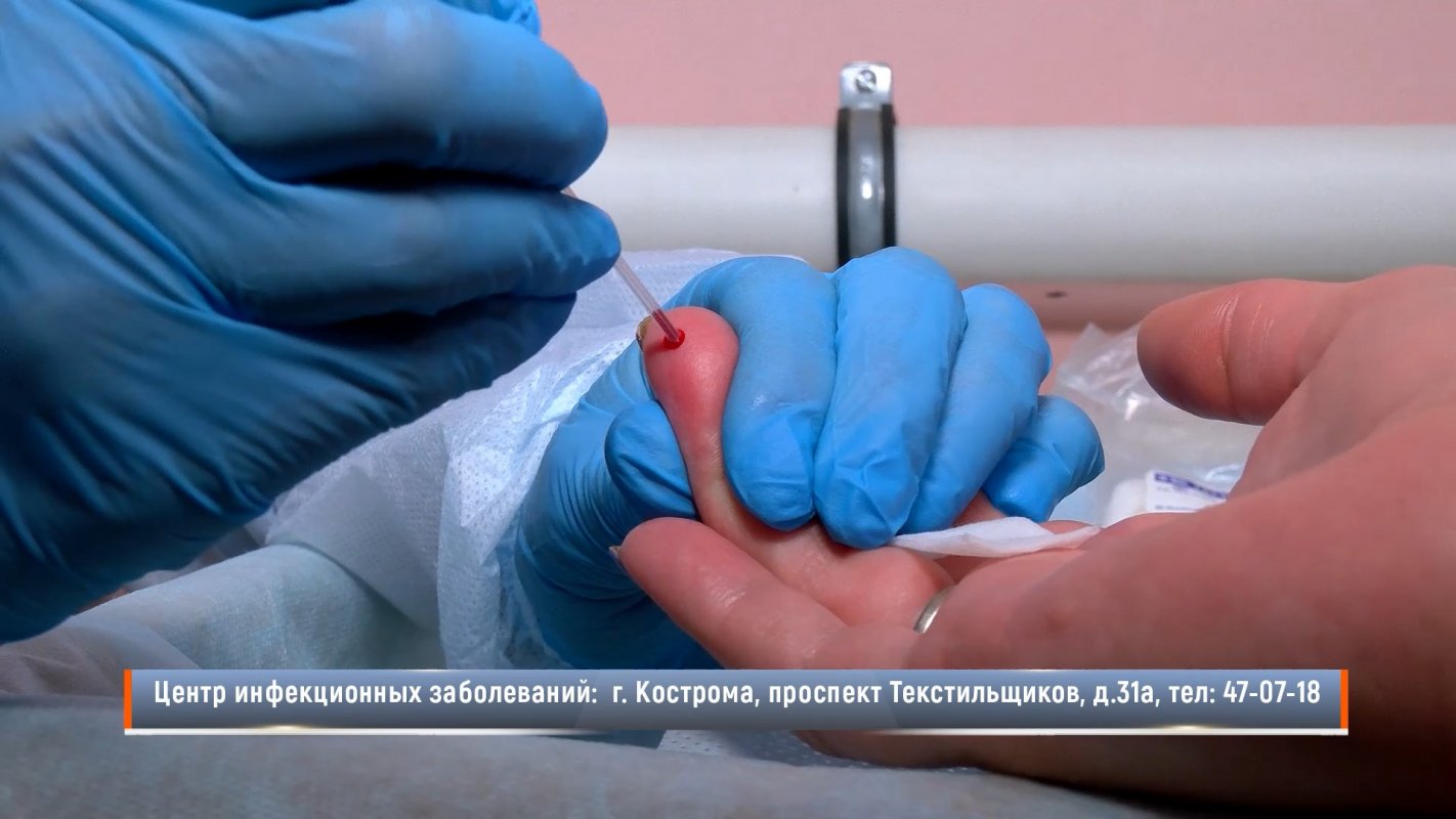 Сегодня в Костроме клиенты МФЦ  могли пройти тест на ВИЧ-инфекцию